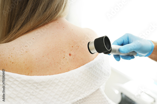a dermatologist examines moles and skin growths on the patient's body using a special device - a dermatoscope. Diagnosis and prevention of melanoma. photo