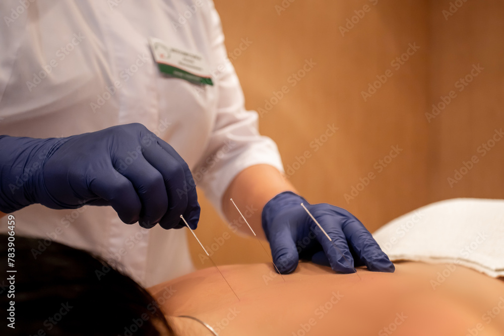 Fototapeta premium non-traditional medicine, medical procedures, health