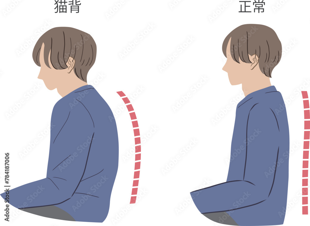 猫背と正しい姿勢の男性のイラストセット Stock Vector | Adobe Stock