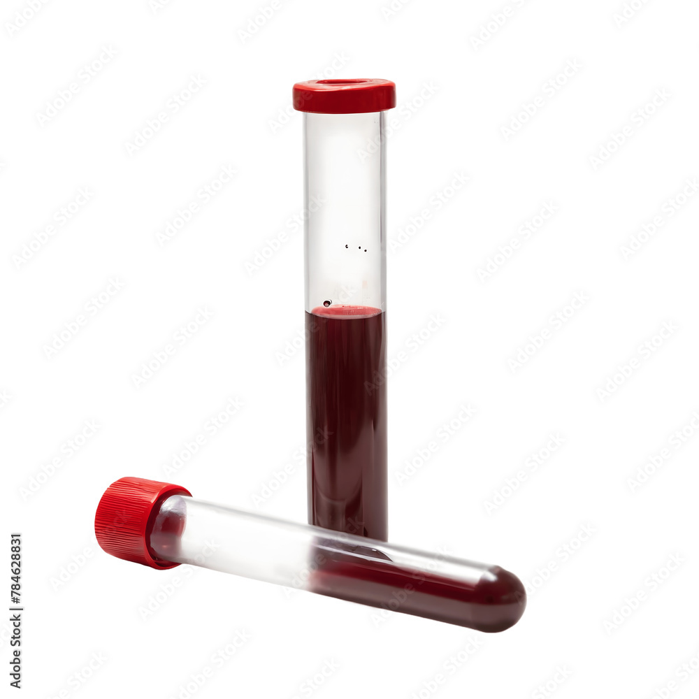 Two blood test tubes filled with samples on a white background, png. Two blood test tubes filled with samples on a white background, png.