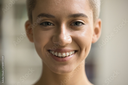 Close up portrait of young 20s blonde European girl with braces, orthodontic treatment for attractive smile and better overall dental health, straighten teeth, correct bite issues, improve appearance photo