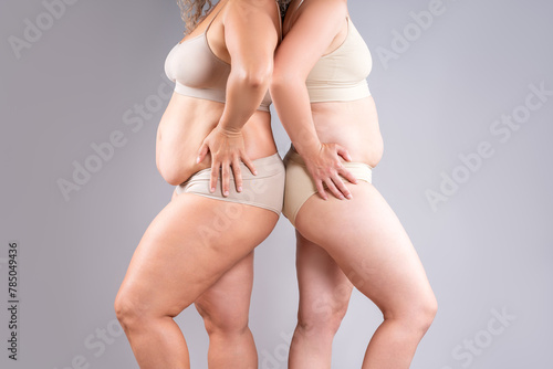 Two overweight women with cellulitis, fat flabby bellies, legs, hands, hips and buttocks on gray background, obese female body, liposuction and plastic surgery concept photo