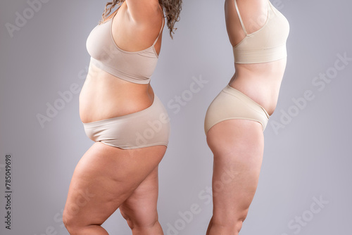 Bild auf Leinwand Two overweight women with cellulitis, fat flabby bellies, legs, hands, hips and