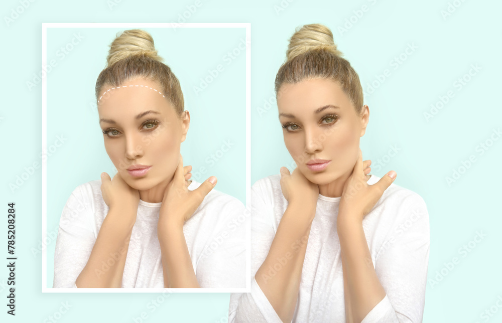 Thinning hair and hair loss,female pattern baldness,Hair transplant Thinning hair and hair loss,female pattern baldness,Hair transplant