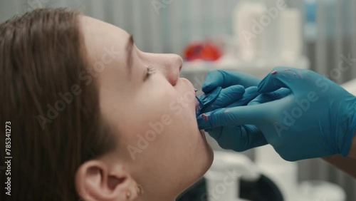 The orthodontist using dental impression tray on woman teeth. Dental spatula with print for dental implant.