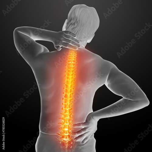 3d rendered illustration of a painful Back photo