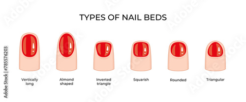 Types of nail beds -04