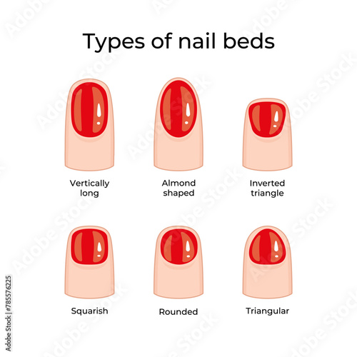 Types of nail beds -02