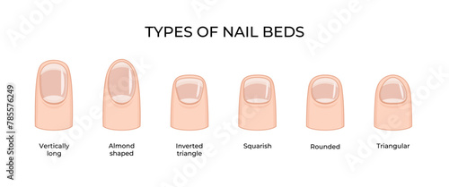 Types of nail beds -03 photo