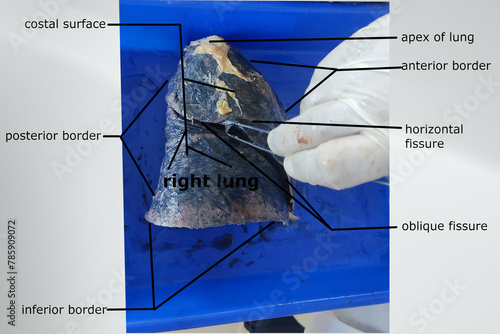 anatomical features of right lung © deepak