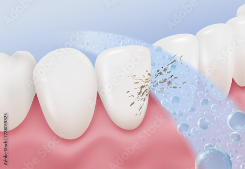 Cleaning teeth removes plaque and dirt between the teeth. Make your teeth white and clean. Advertising media for fluoride toothpaste, mouthwash, dental clinics. Realistic vector file.