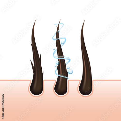 Vector hair and follicles, representing aspects of hair care, dermatology, and health. Covering topics like hair loss, treatment, and protection. Shampoo advertising Not AI.