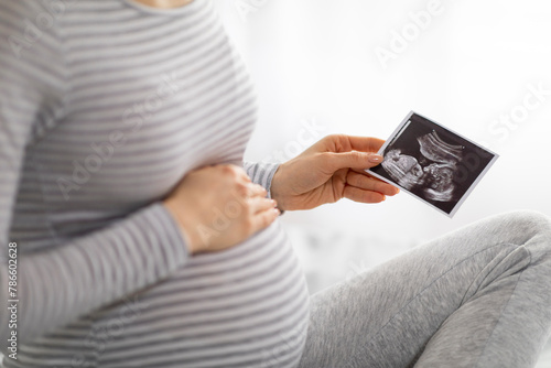 Pregnant woman holding sonogram of baby, cropped photo