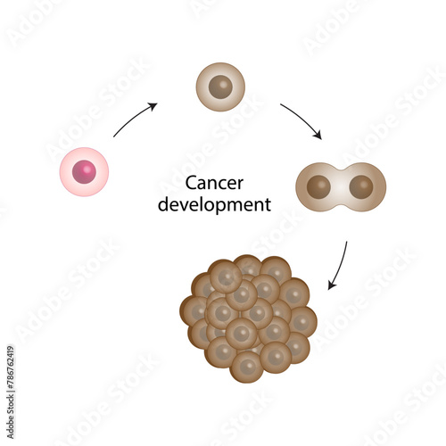 Cancer disease development. Malignant tumor. Medical biological, scientific vector illustration.	