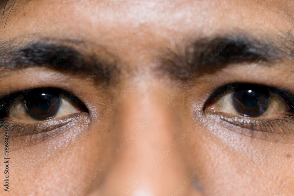 Close up of an Asian mans eyes with a brown tint Close up of an Asian mans eyes with a brown tint