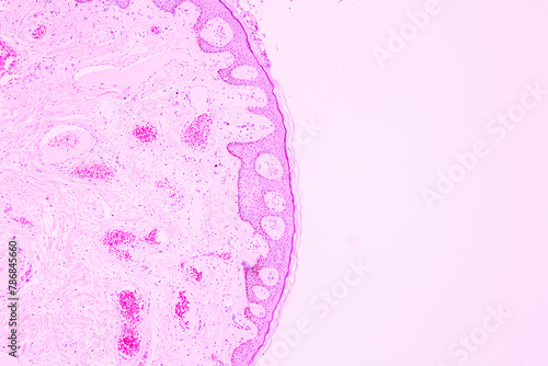 Obraz na plátně Backgrounds of human cells tissue of lung human under the microscope in pathology lab