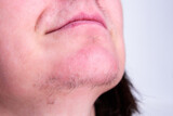 Woman's face with moustache and hairs on chin.
