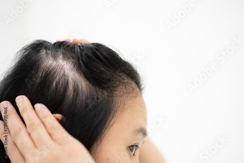 Asian woman parting her hair revealing hair loss or thinning hair