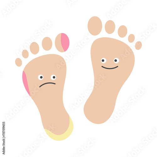 Human feet illustration. Healthy foot and dermatology problem foot. Vector 