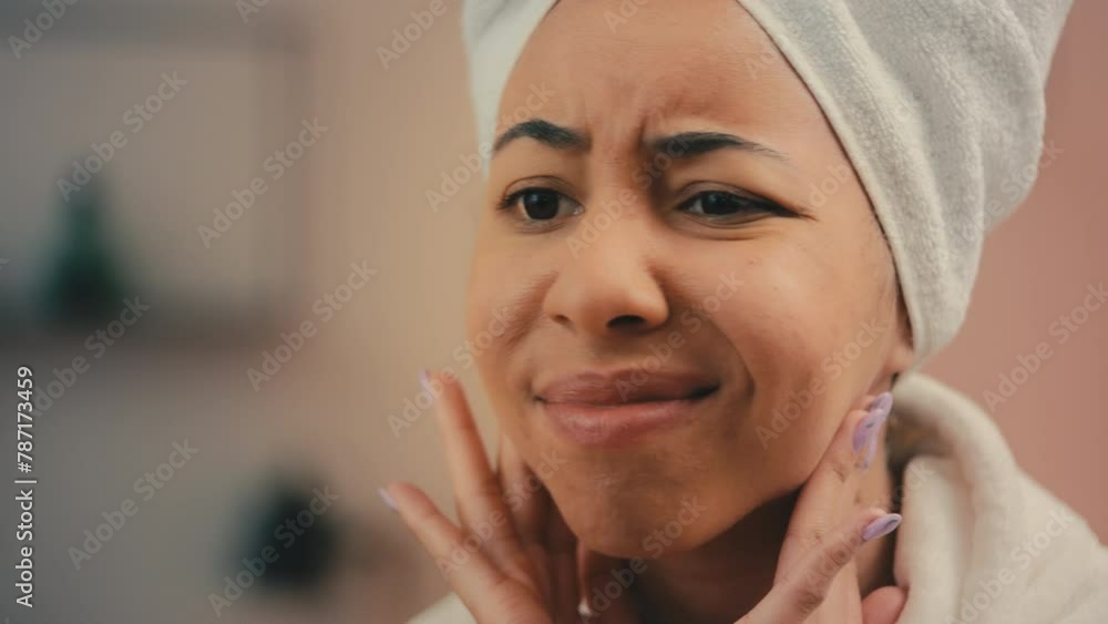 African American woman unhappy with her face skin condition, acne problem African American woman unhappy with her face skin condition, acne problem