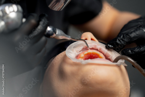 close up in a dental office female dentist in a cap is routinely cleaning the teeth of a young beautiful girl photo