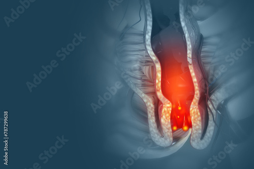 Haemorrhoids (piles) on scientific background. Virus infection. 3d illustration