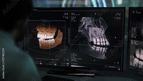 Doctor deals with examination of dental diagnostic of patient mouth cavity. Dental diagnostic system examination of a 3D skull. Dental diagnostic examination of the damaged jaw. Orthodontology. photo