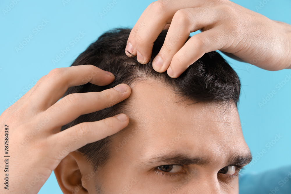 Young man with hair loss problem on blue background, closeup Young man with hair loss problem on blue background, closeup