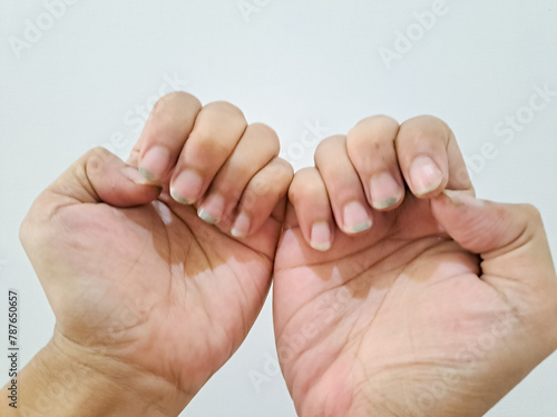 Dirty nails. a man's dirty fingernails on white background. damaged nail without manicure with dirt close-up 