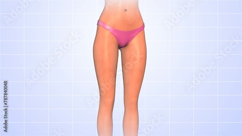 Thigh fat reduction medical animation