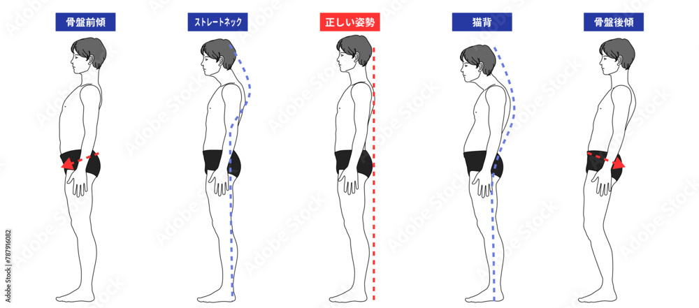 良い姿勢と悪い姿勢のイラスト 骨盤前傾 後傾 猫背 ストレートネックの男性 全身横向き