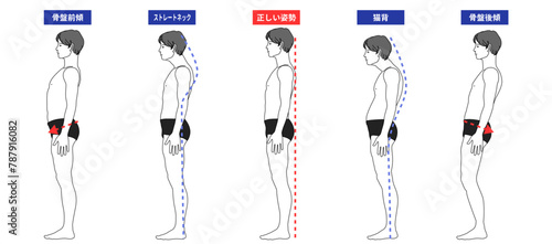 良い姿勢と姿勢でストレートネック 猫背 骨盤後傾 骨盤前傾になっている全身横向きの男性のイラスト