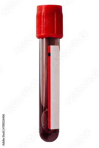 Fotografia Blood test tube transparent png