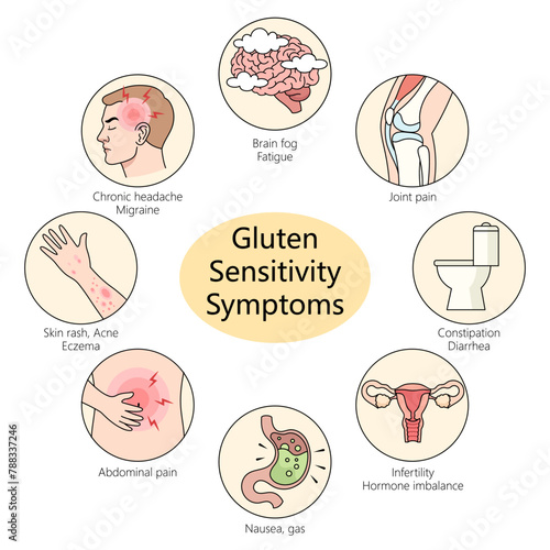 gluten sensitivity symptoms including migraines, joint pain, and skin rashes diagram hand drawn schematic vector illustration. Medical science educational illustration
