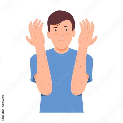 Illustration of a male patient raising both arms with a skin disease. Rash on arms or body. Flat style vector