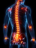 Illustration of back pain, highlighted in red on the spine area, on transparent background