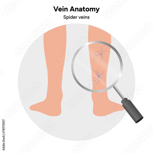 Vein anatomy zoom, spider veins