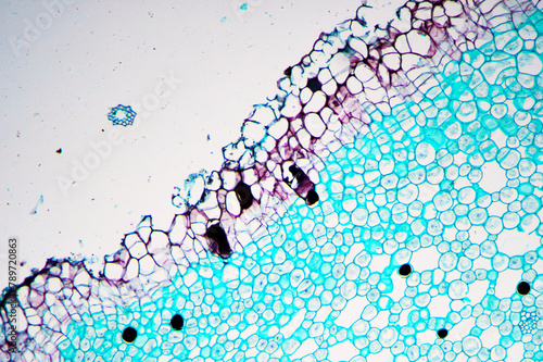 grassleaf sweelflag rhizome (Acorus gramineus) plant cells micrograph photo