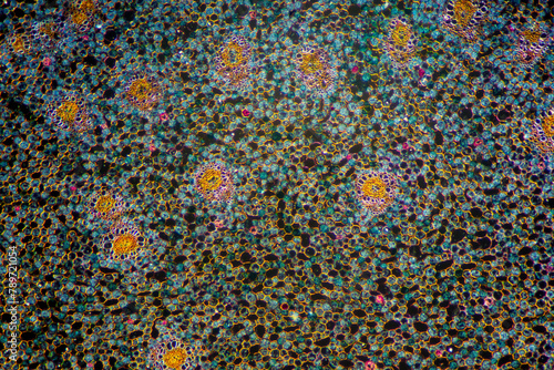 grassleaf sweelflag rhizome (Acorus gramineus) plant cells micrograph