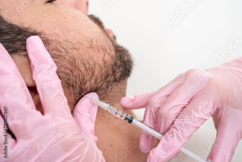 Doctor performing jawline contouring with Botox: cosmetic procedure for male patient's facial definition and skincare, Enhancing jaw using botulinum toxin