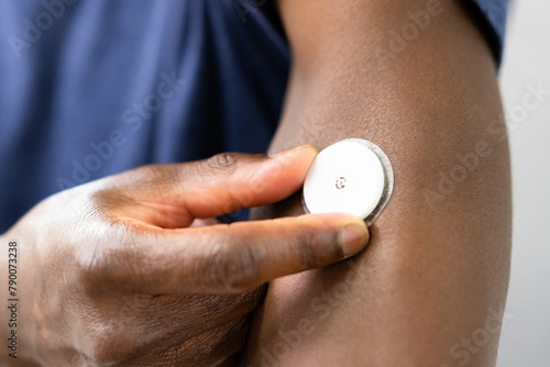 Tableau sur toile Man Testing Glucose Level With A Continuous Glucose Monitor