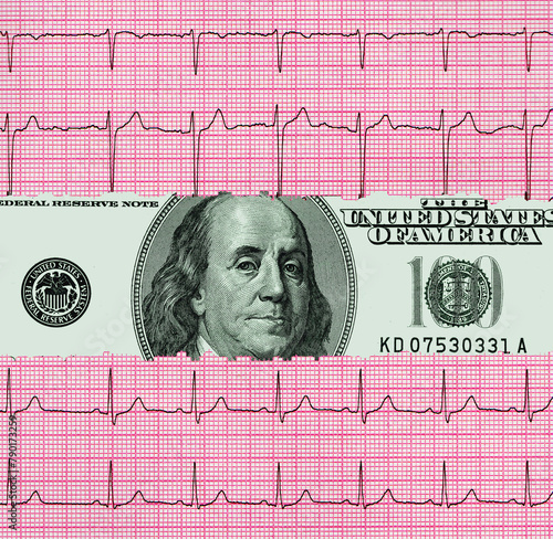 One hundred dollar bill between two pieces of cardiogram results