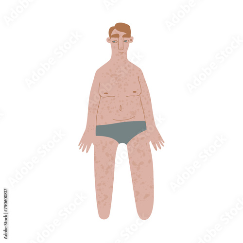 Flat Irish man in underwear. Pale ad freckled skin person with redhead in cartoon style for multinational and diversity designs. Vector illustration.