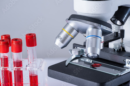 A microscope with a slide containing red blood cells. Microscope is on a laboratory table next to a few red blood cell tubes.