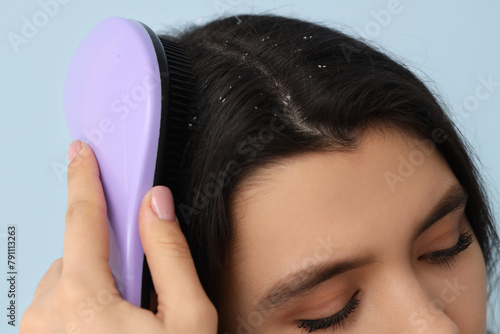 Young woman with dandruff p...