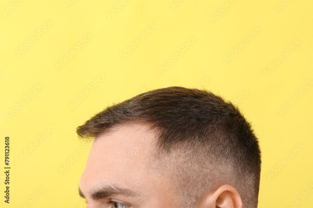 Obraz premium Young man with hair loss problem on yellow background, closeup
