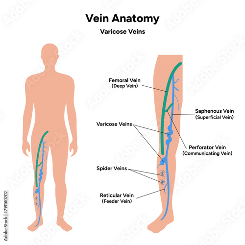 Vein anatomy, varicose veins