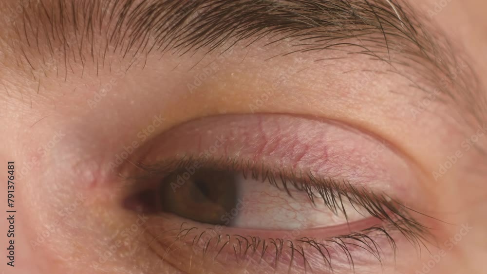 Close up eye moves sides, Ill Eyeball moving upside and left to right