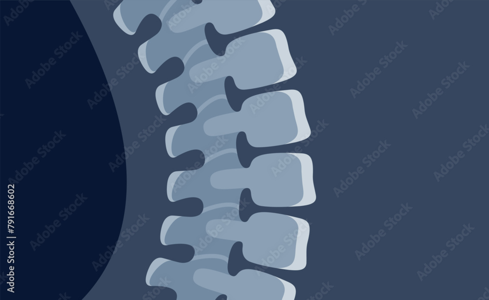 Human spine x ray image anatomical cartoon bone science medical ...