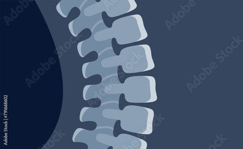 Human spine x ray image anatomical cartoon bone science medical healthcare vector flat illustration